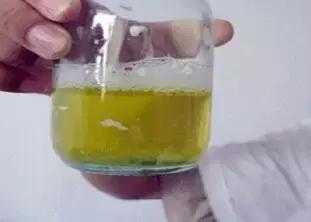肾病患者出现这五大症状是,可以判断为肾病综合征!