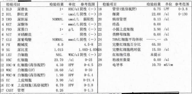 为什么尿常规检查结果会不准确,这几点值得注意!