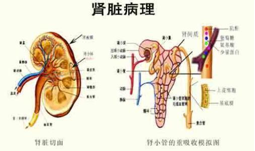 如果存在这些症状,警惕过敏性紫癜肾炎可能发生了!