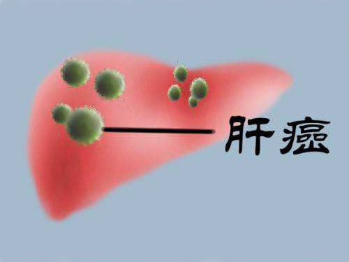 甲胎蛋白(AFP)升高一定是肝癌?也许你一直错了!